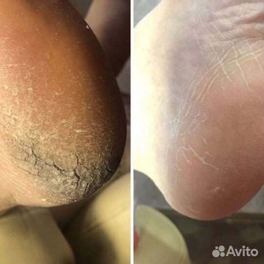 Педикюр мужской, женский, маникюр