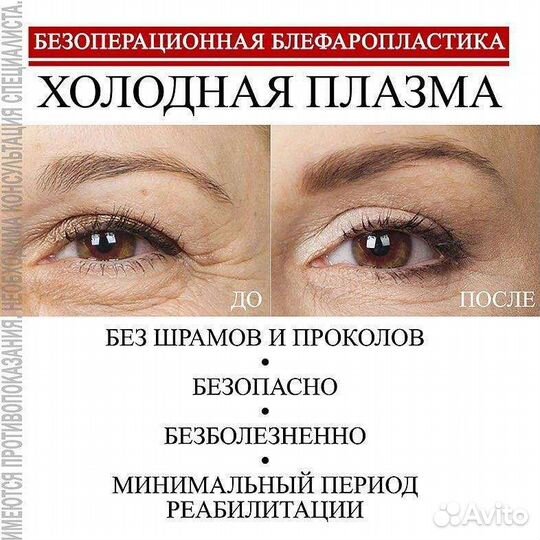 Холодная плазма омоложение лифтинг шлифовка модели