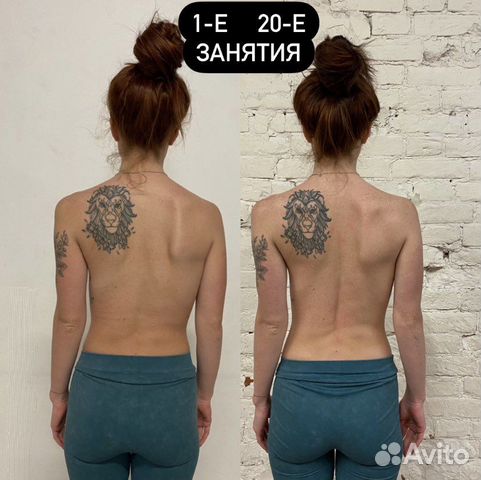 Здоровая спина,осанка,оздоровление спины