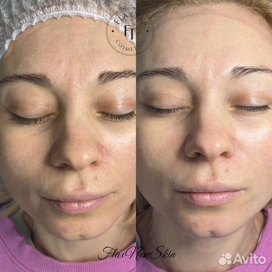 Услуги косметолога