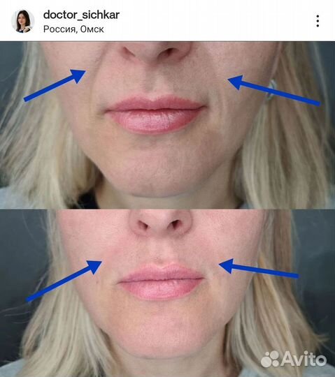 Косметолог / Ботокс / Чистка / Контурная пластика