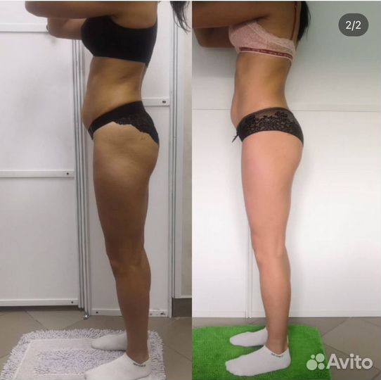 Ищем моделей/похудение/коррекция фигуры