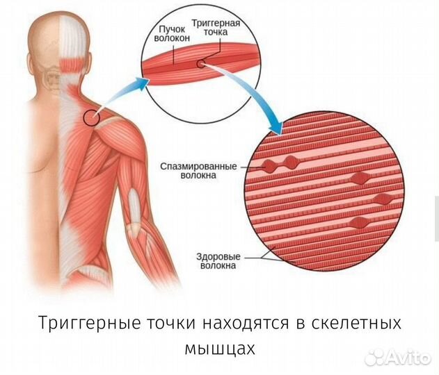 Массаж миофасциальный