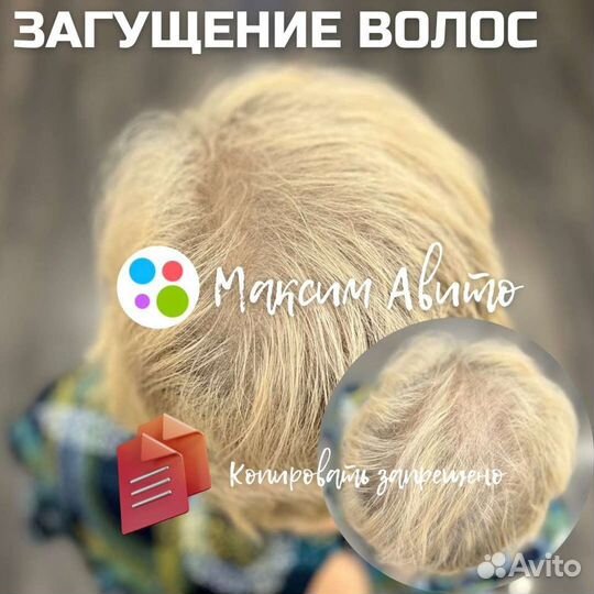 Трихопигментация головы