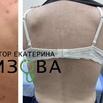 Врач онлайн диетолог, дерматолог, терапевт, пп, Кропивницкий
