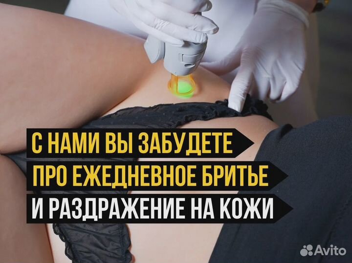 Лазерная эпиляция