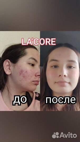 Маска для лица