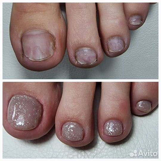 Педикюр на дому