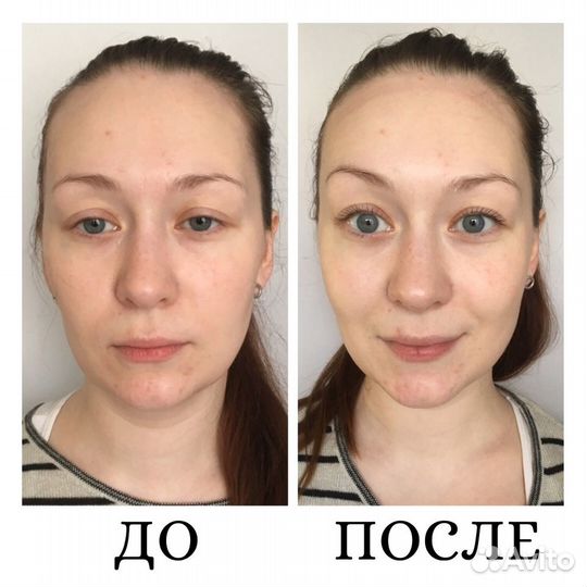 Лечебный массаж
