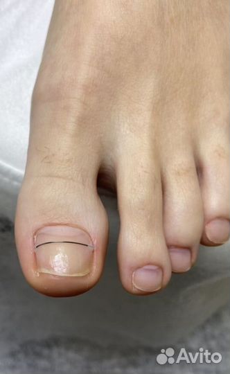 Лечебный педикюр/ подолог с мед.образованием