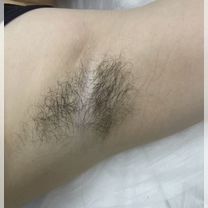 Депиляция, шугаринг, Чита