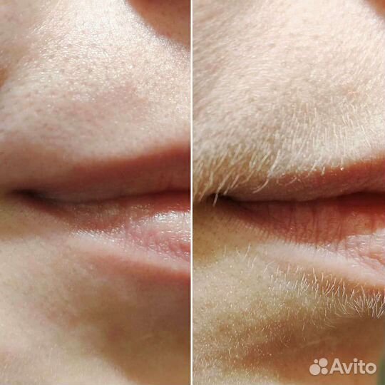 Шугаринг депиляция воск Автово Кировский завод