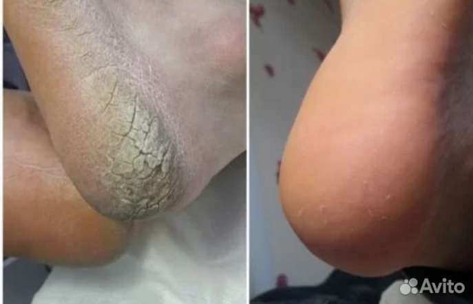 Маникюр и педикюр, гель лак