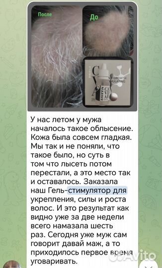 От выпадения волос
