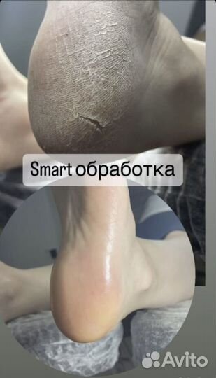 Маникюр/Педикюр