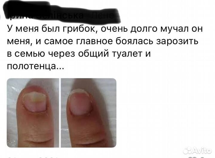 Актилайн - средство убирает грибок кожи и ногтей