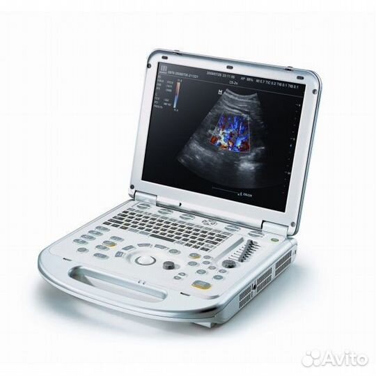 Узи аппарат Mindray M7