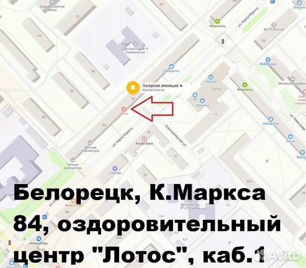 Лазерная эпиляция