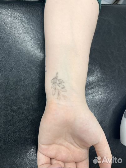 Лазерное удаление тату татуажа перманента