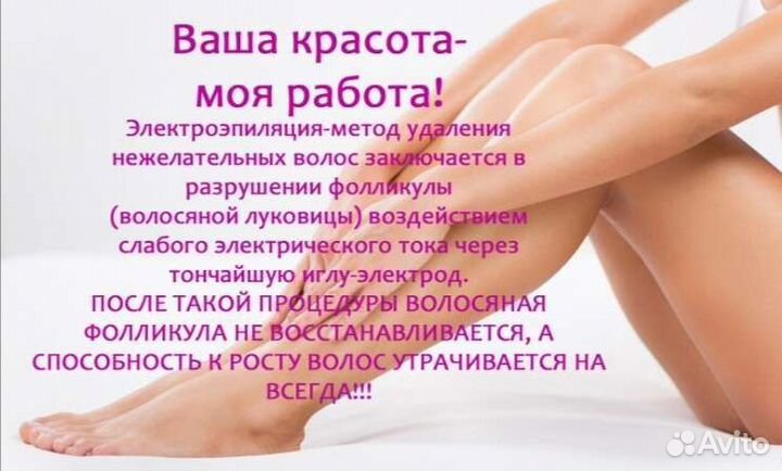 Электроэпиляция