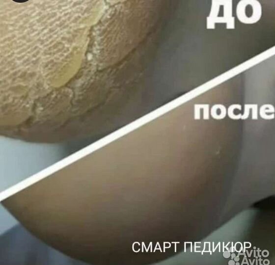 Маникюр смарт-педикюр 24 часа