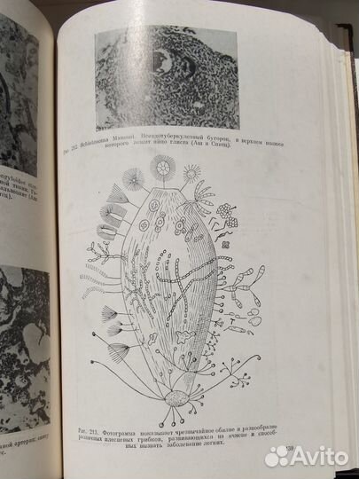 Дифференциальная диагностика заболеваний легких