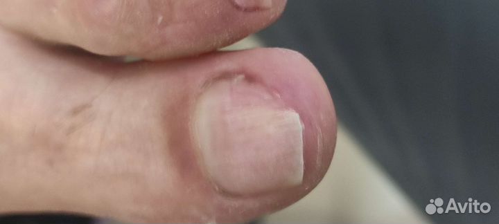 Подолог (Солнечный 2 )