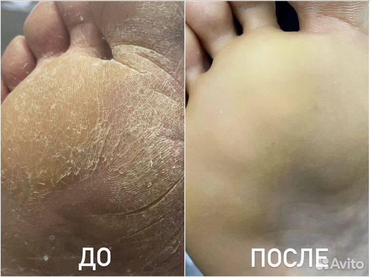 Подолог с выездом на дом