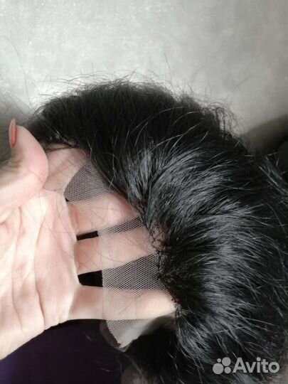 Система замещения волос