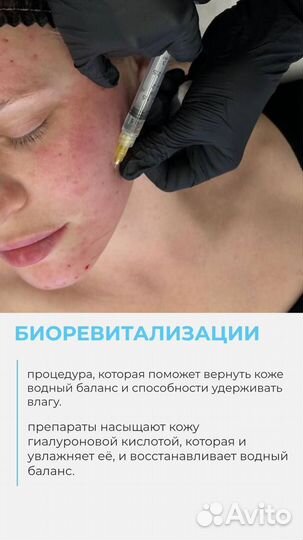 Биоревитализация. Мезотерапия