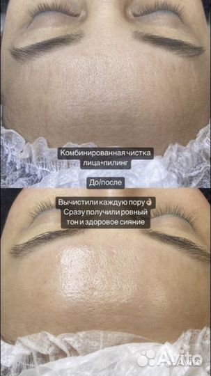 Обучение косметолог-эстетист