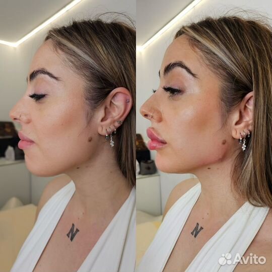 Модель на увеличение губ, углы Джоли