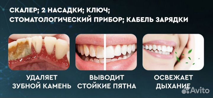 Ультразвуковой скалер