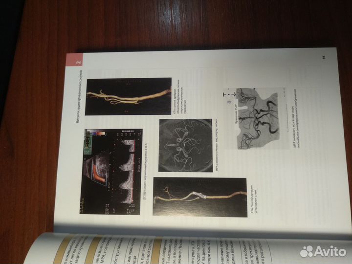 Справочник по неврологии Неттера