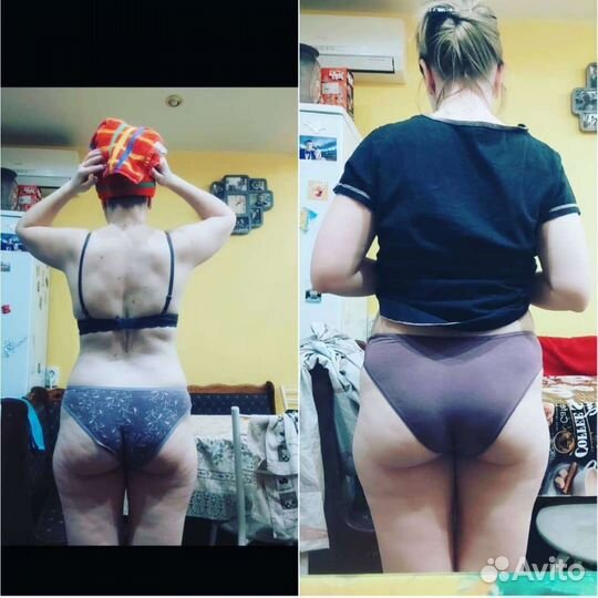 Карамельная липосакция