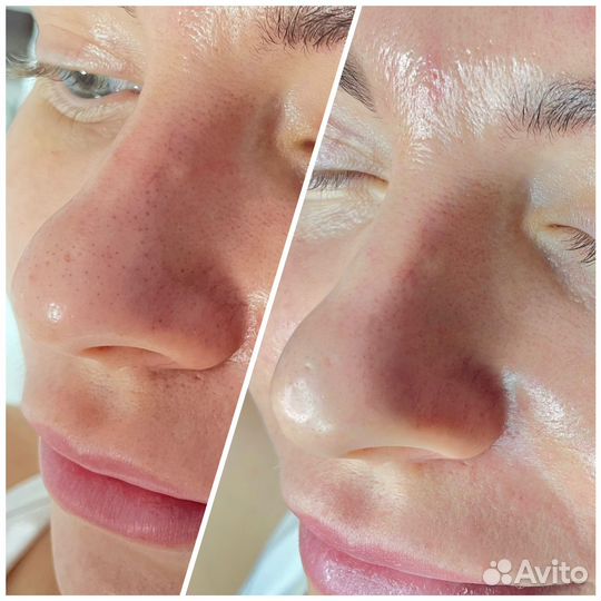 Услуги косметолога