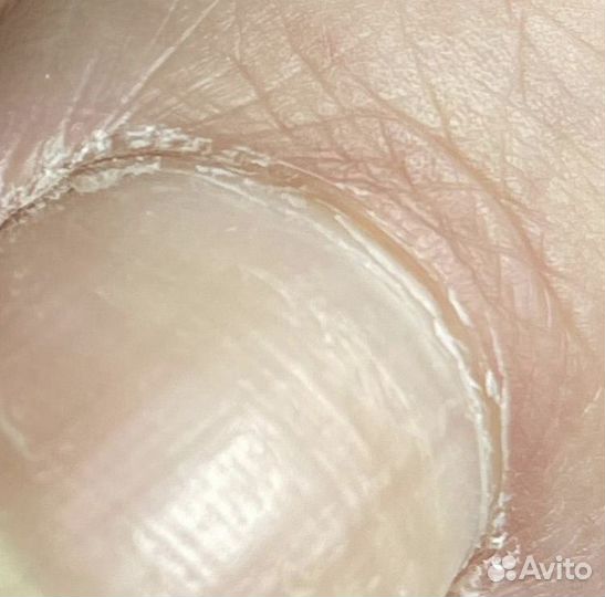 Гигиенический педикюр