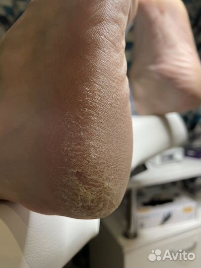 Смарт педикюр