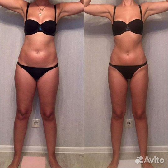 Антицеллюлитный массаж, массаж тела