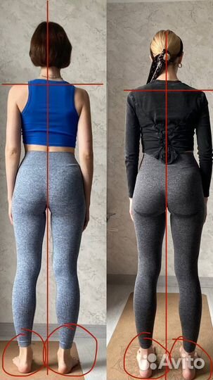 Осанка, плоскостопие, похудение, врач