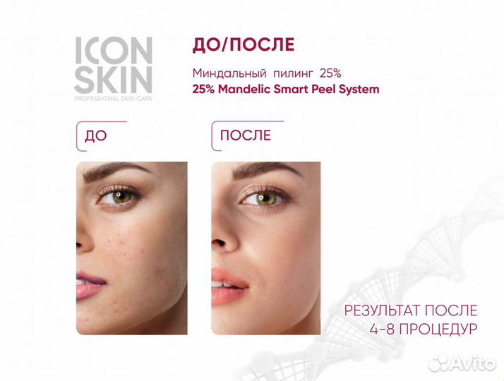 Icon skin Пилинг для лица миндальный 25%