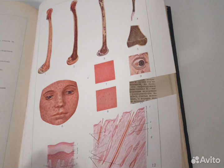 Большая медицинская энциклопедия