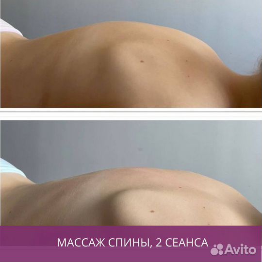 Массаж (все виды), LPG массаж, коррекция фигуры