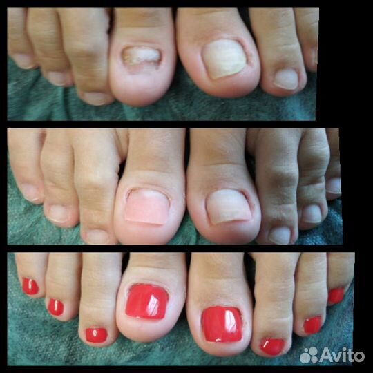 Мастер педикюра, подология