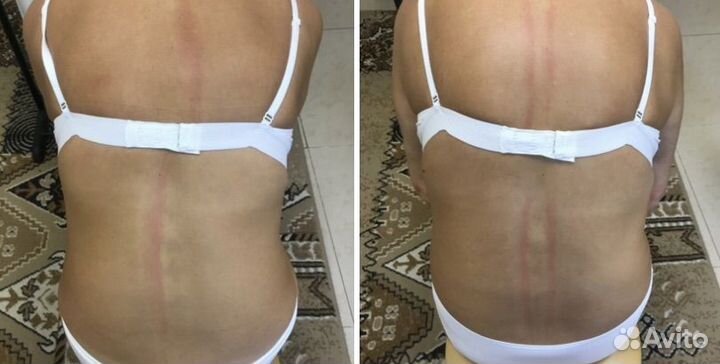 Мануальный массаж. Костоправ. Хиропрактик