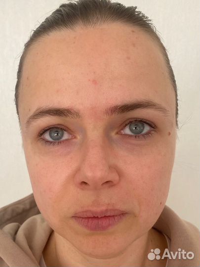 Массаж лица и тела