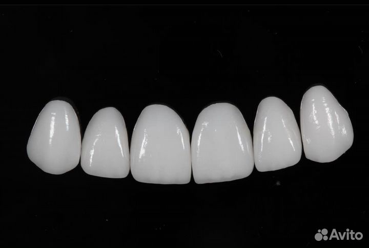 Зубные Коронки