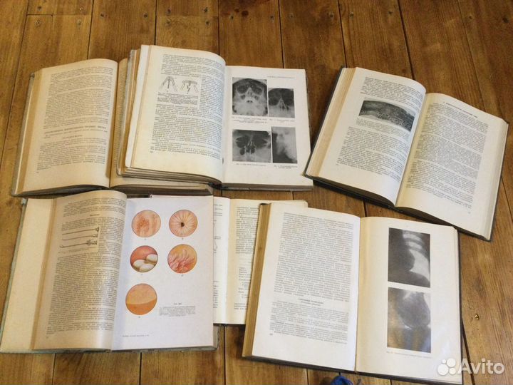 Антикварные книги, учебники по медицине 1940 х гг