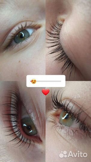 Брови, ресницы