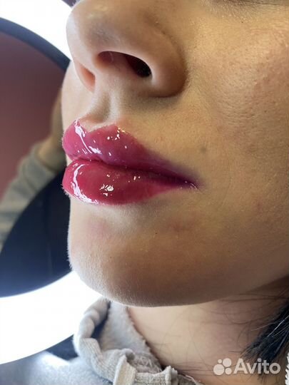 Увеличить губы